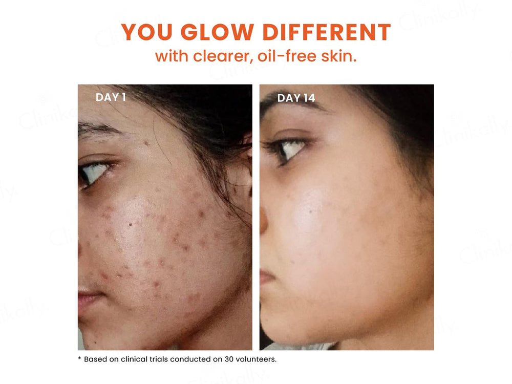 Foxtale 12% Niacinamide + Azelaic Acid Clarifying Serum