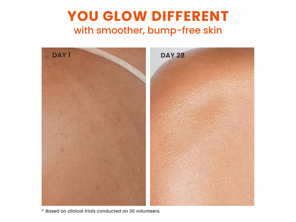 Foxtale 2% Salicylic Acid Exfoliating Body Wash