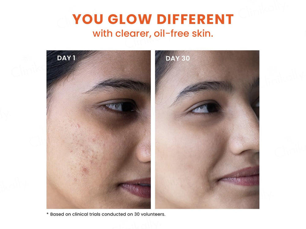 Foxtale Acne Control Cleanser