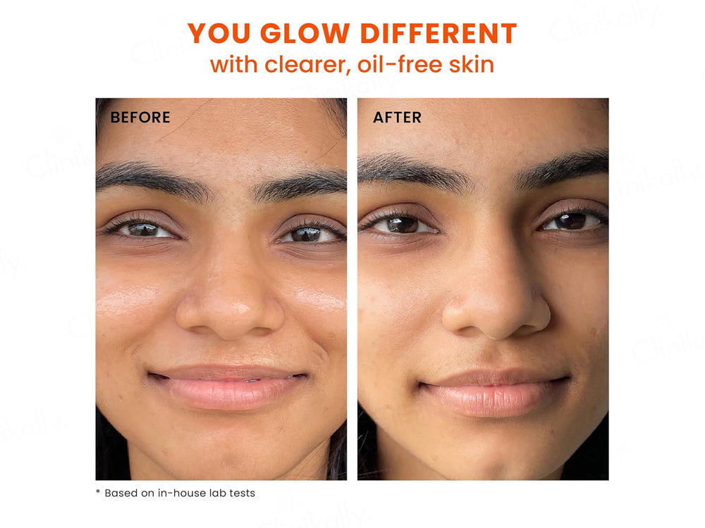 Foxtale Mattifying Sunscreen SPF 70 PA++++