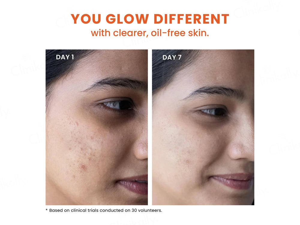 Foxtale Oil & Acne Control Face Wash