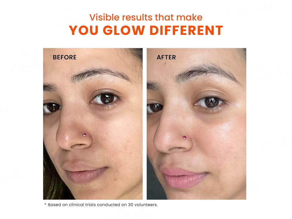 Foxtale Skin Radiance Face Mask