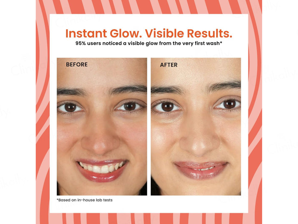 Foxtale Super Glow Face Wash