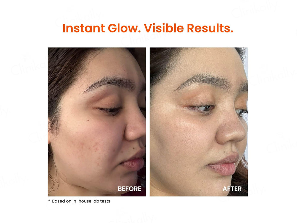 Foxtale Super Glow Moisturizer