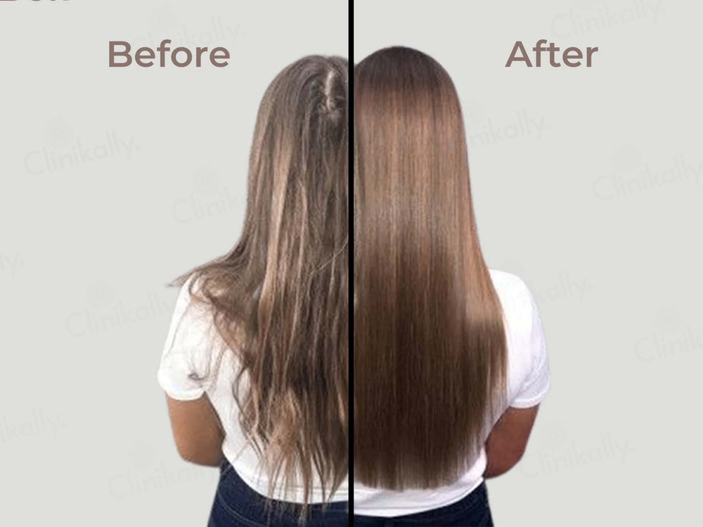 Herbmagic Honey & Linseed Advance Hair Growth Serum