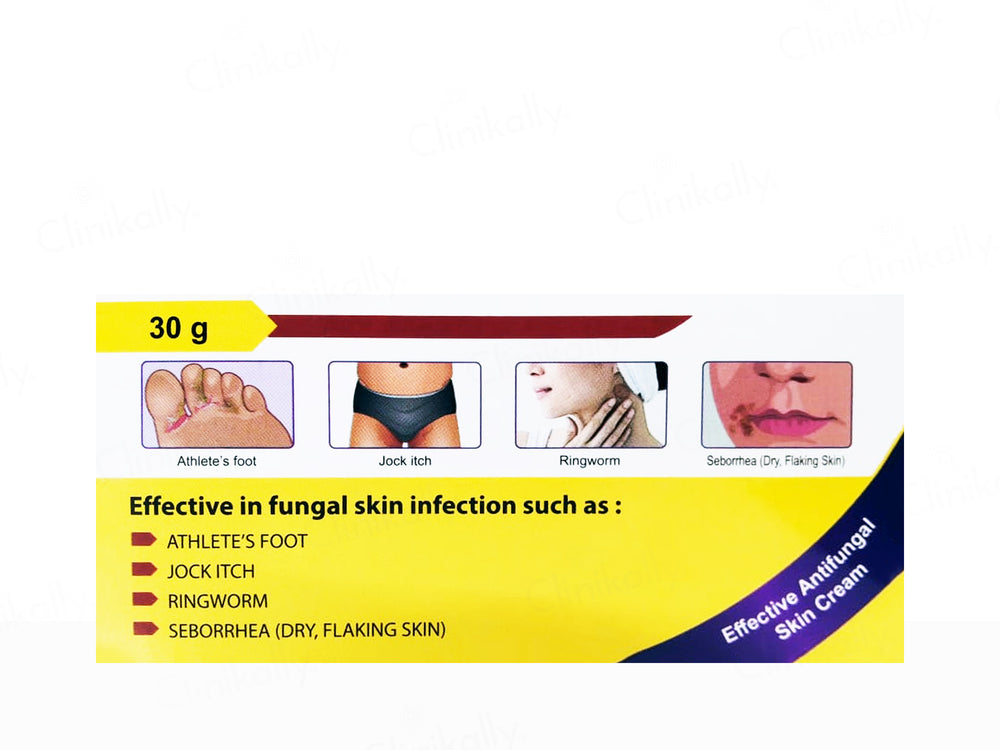 Ketomac Antifungal Skin Cream