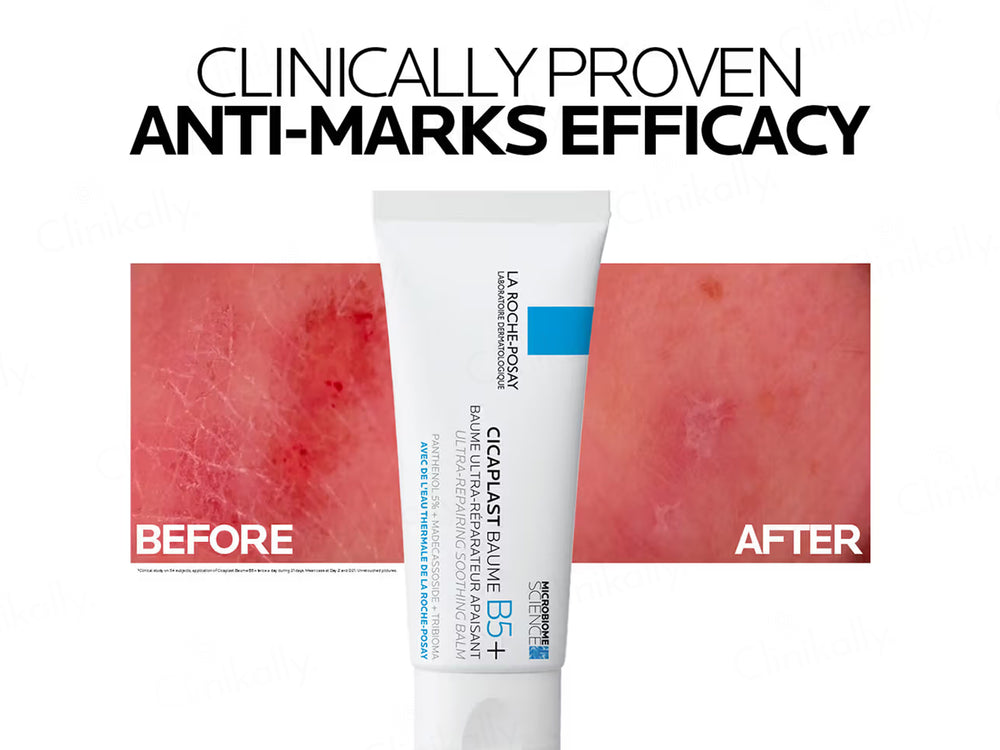 La Roche-Posay Cicaplast Baume B5+ Soothing Balm