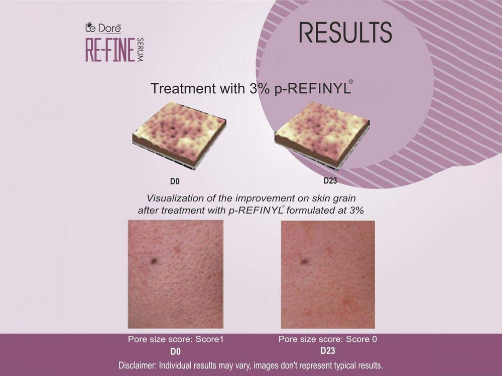 Le Dore RE-FINE Pore Refining Anti Acne Serum