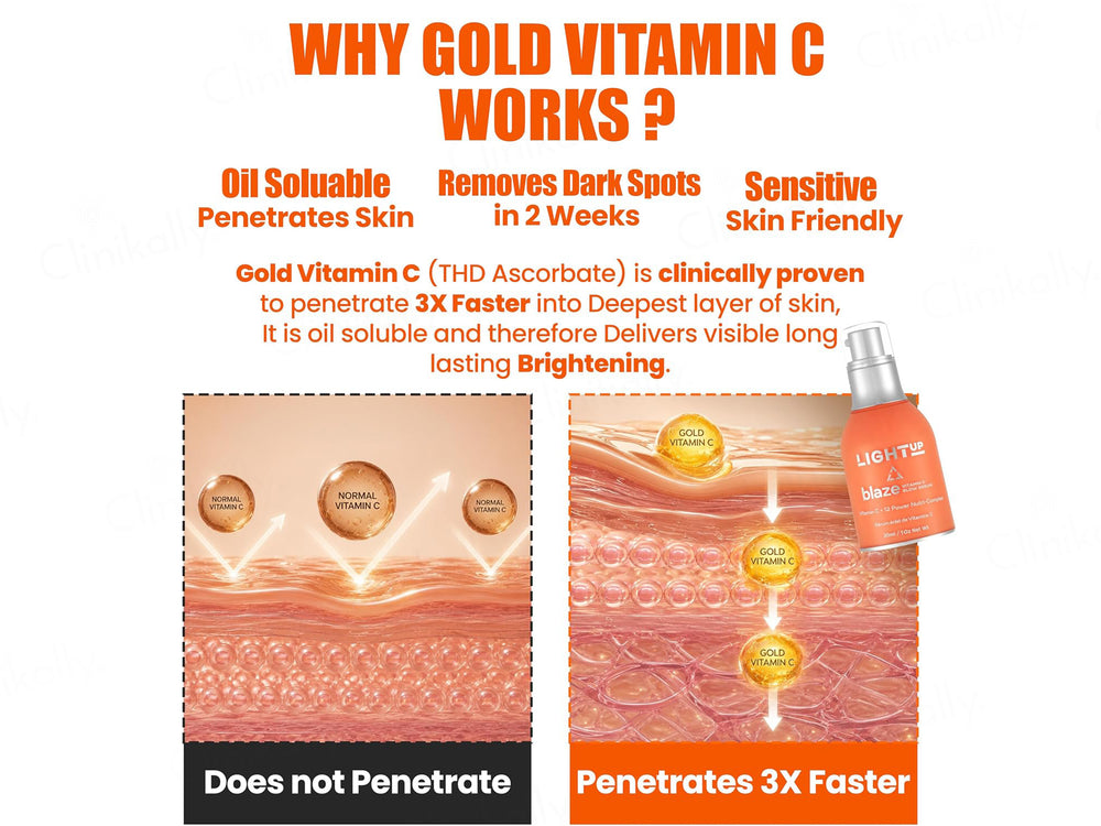 Light Up Blaze Vitamin C Glow Serum