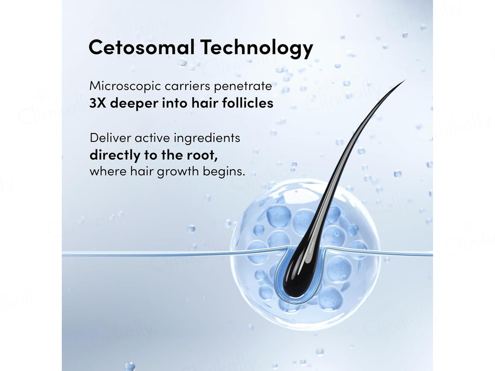 Man Matters Minoxifin Advance Hair Topical Solution