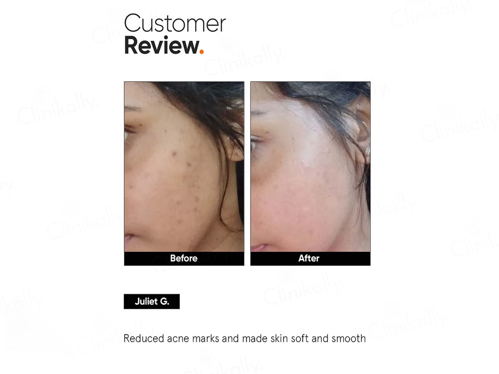 Minimalist 5% Niacinamide Face Serum