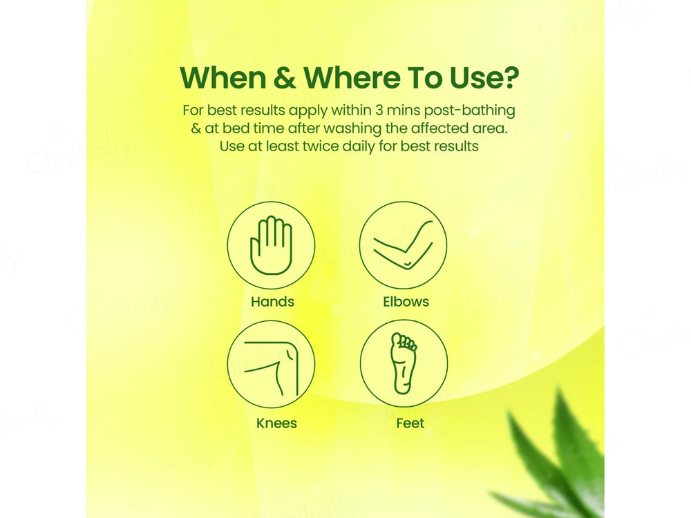 NMFe Urea and Aloe Vera Cream For Very Dry Skin