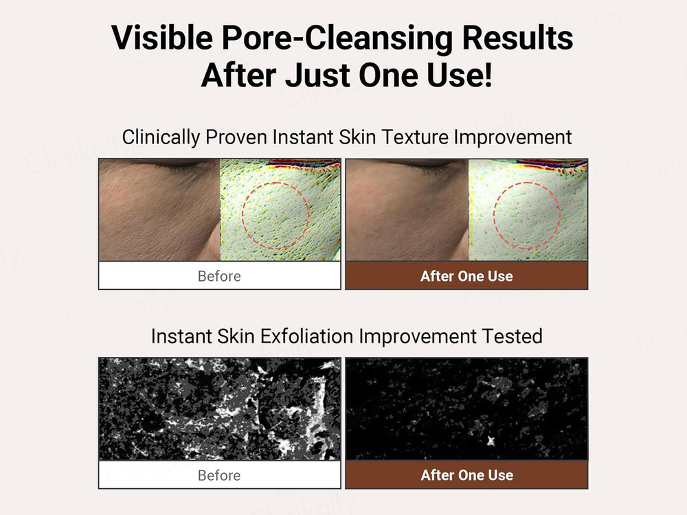 Neaf Neaf Yulmu Scrub Wash Off Mask