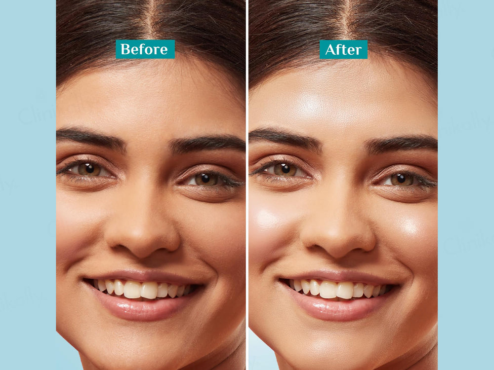 Pilgrim Korean Rice Water Hydra Glow Light Gel Cream Moisturizer