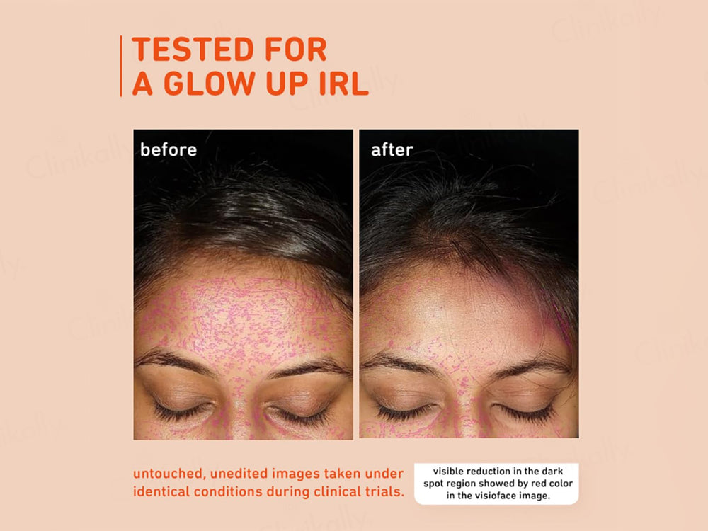 Plum 15% Vitamin C Glow Boost Face Serum With Mandarin