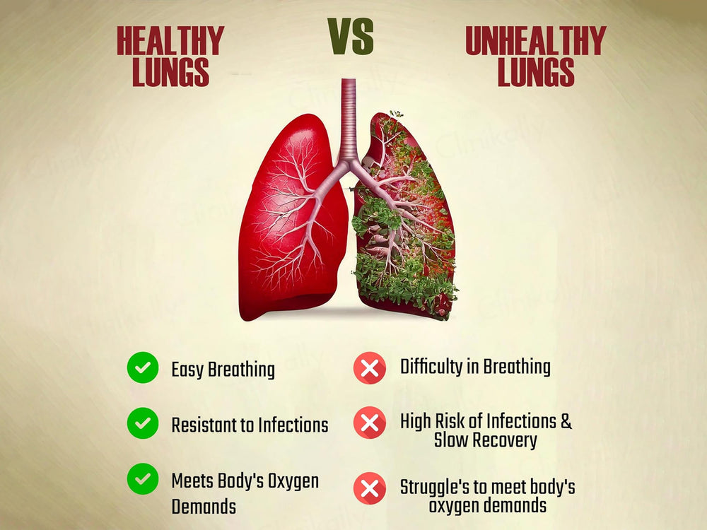 Pure Nutrition Lung Detox Effervescent Tablet - Lime Lemon Flavour