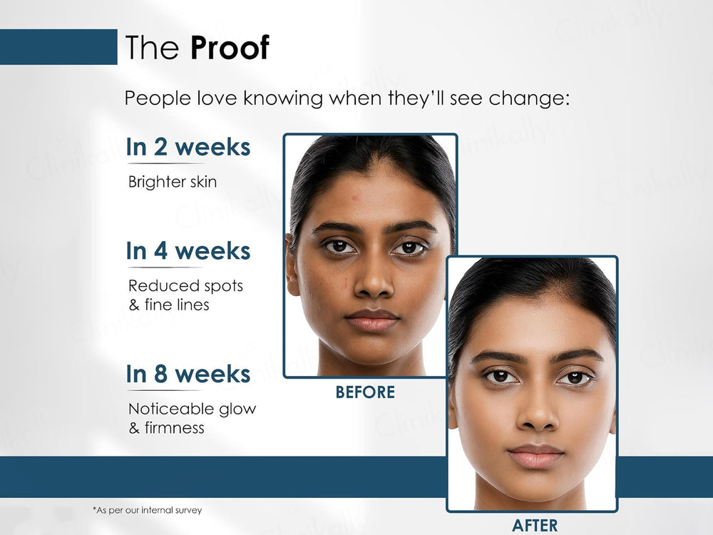 Radiplex Emolight Advanced Skin Radiance & Anti-Aging Nutraceutical Tablet