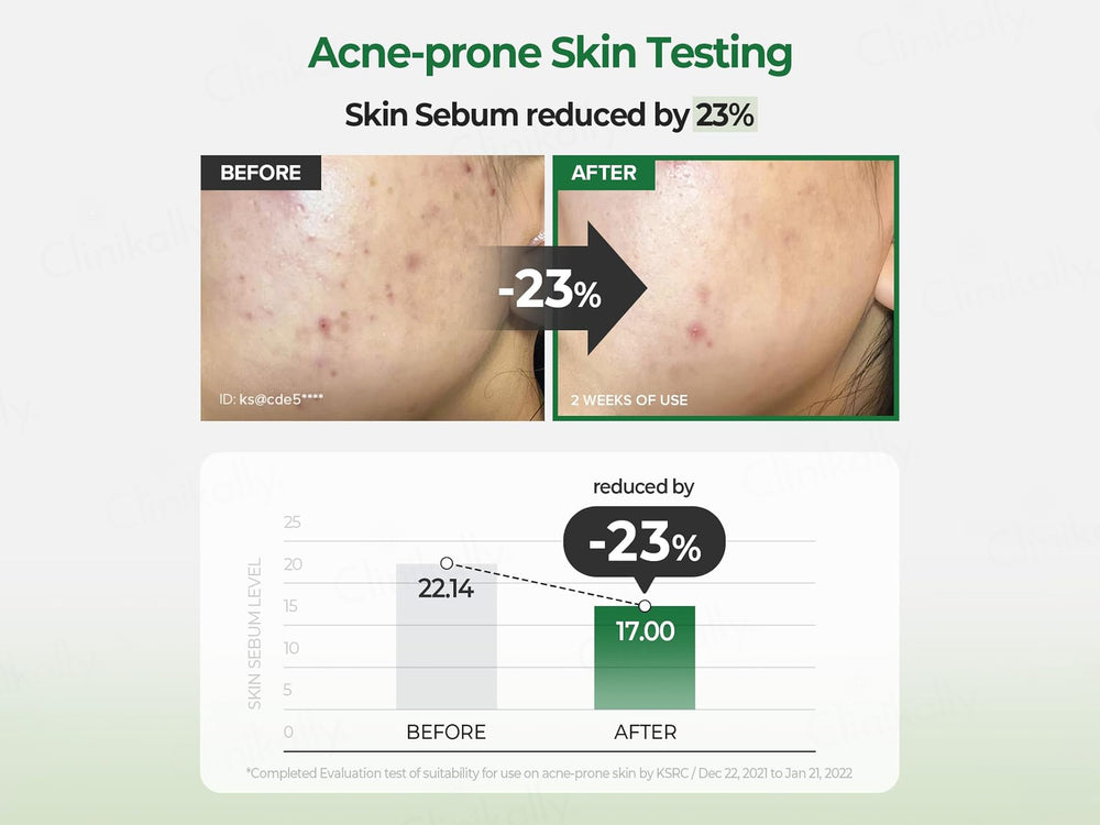 SKINFOOD Pantothenic Water Parsley Clear Pad