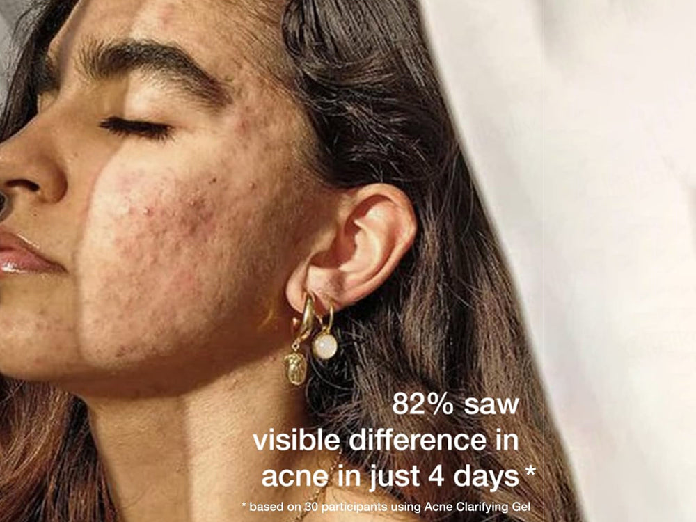 SKOG FAG Acne Clarifying Treatment Gel