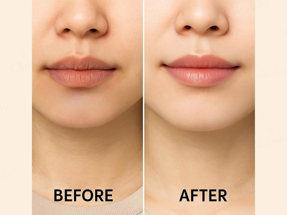 SKOG FLR Lip Repair Oil