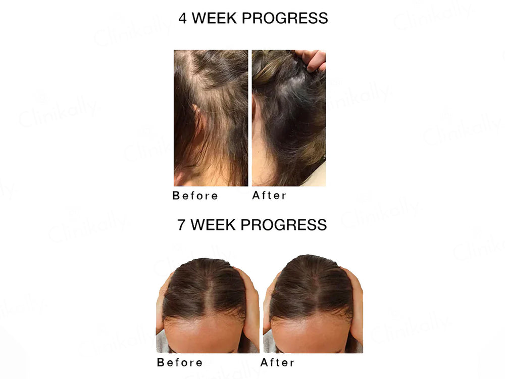 SKOG HR Super Hair Repair Oil