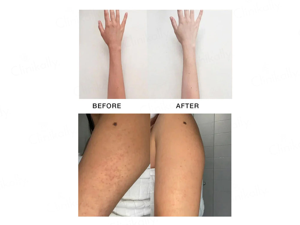 SKOG ODC De-Tan Cream