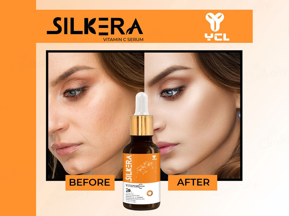 Silkera 20% Vitamin C Serum