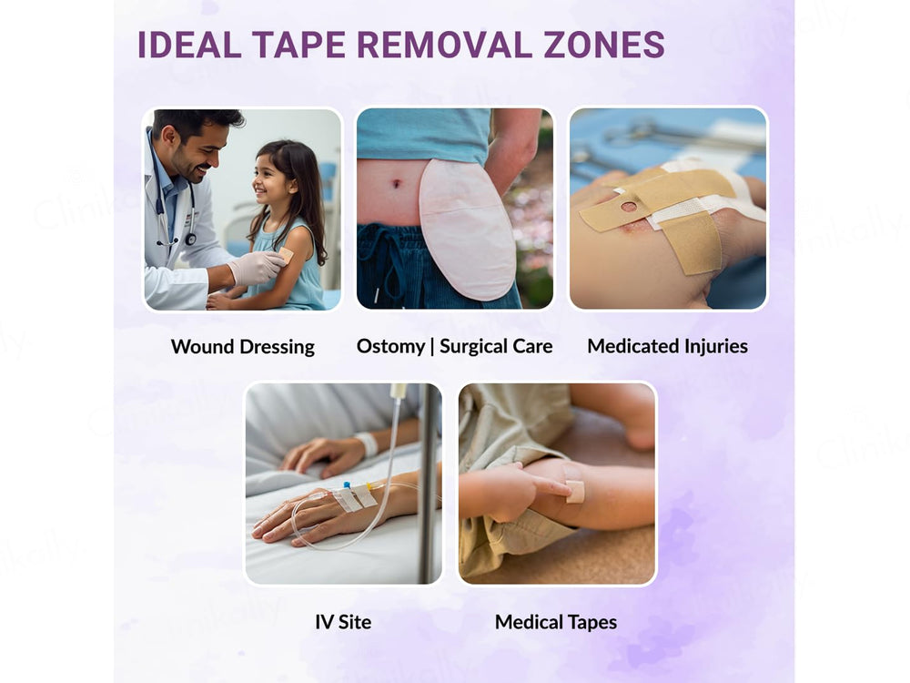 Soreze Cleanse Medical Adhesive Remover Spray