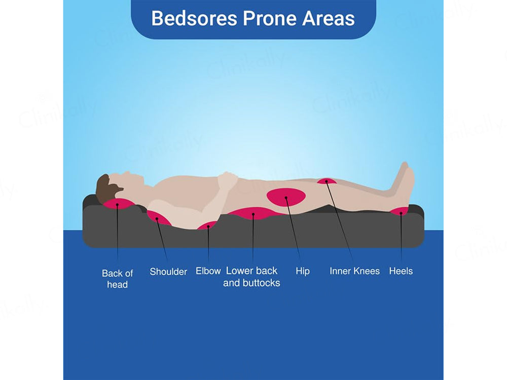 Soreze Silicone Barrier Gel