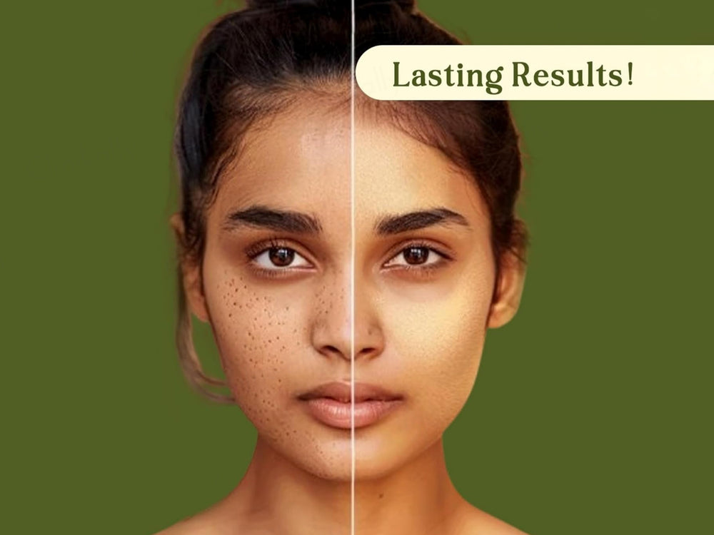 Suun Ayurveda Phyto Pore Refiner Face Serum