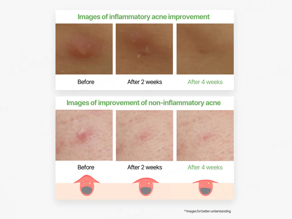 Thank You Farmer Sun Project Skin-Relief Sun Cream Sunscreen SPF 50+ PA++++