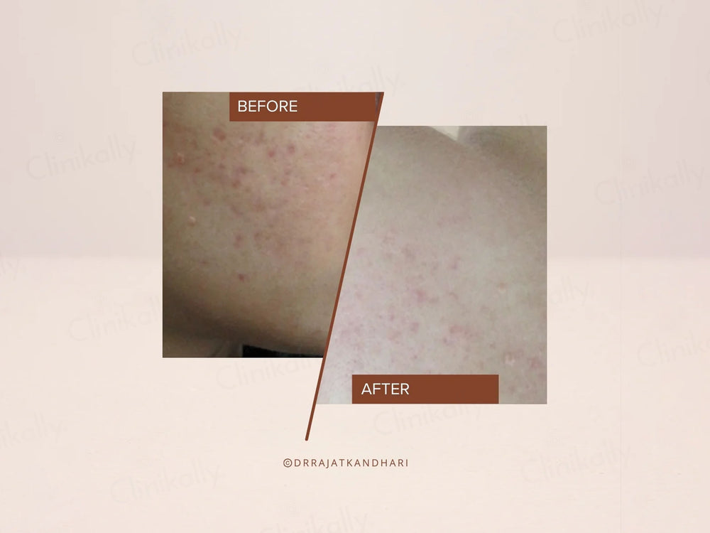 The Facecraft Project Clean Gentle Face Wash & Mask