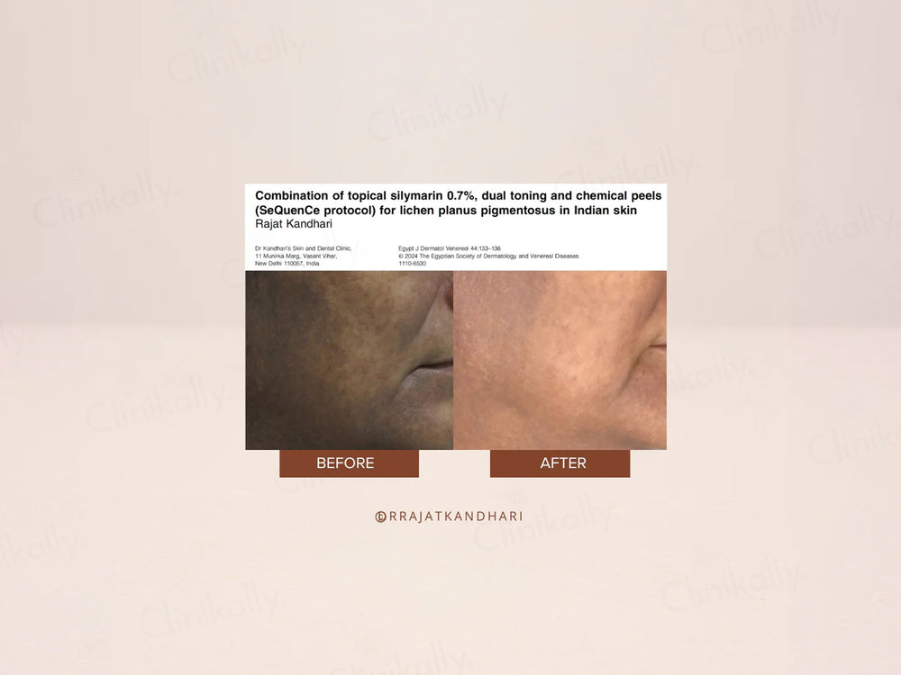 The Facecraft Project Restore Retinol Skin Brightening Cream