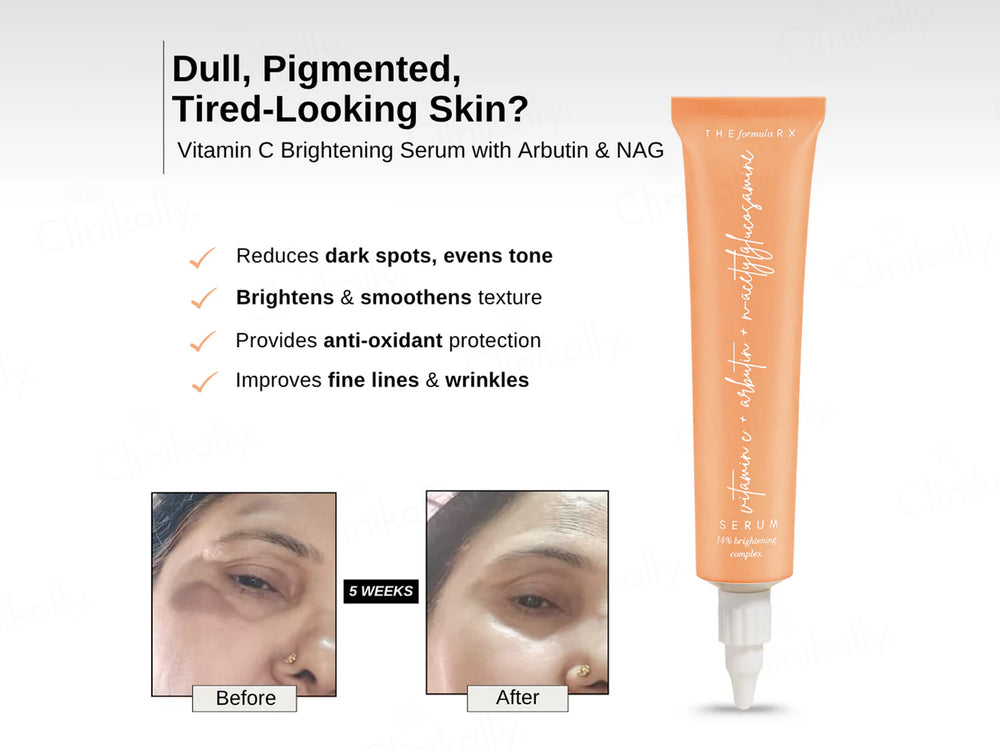 The FormulaRx Vitamin C Brightening Serum