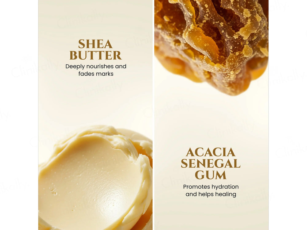 Uniqaya Anti Stretch Mark Body Butter