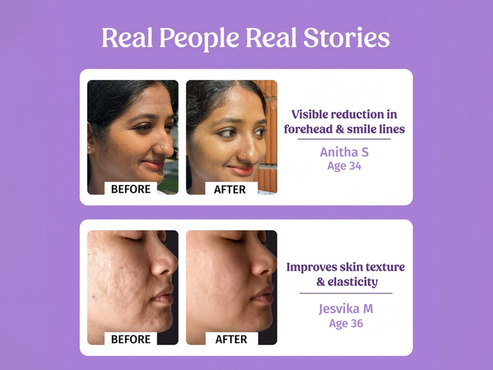 Vilvah Store Better Ageing Overnight Skin Renewal Face Serum