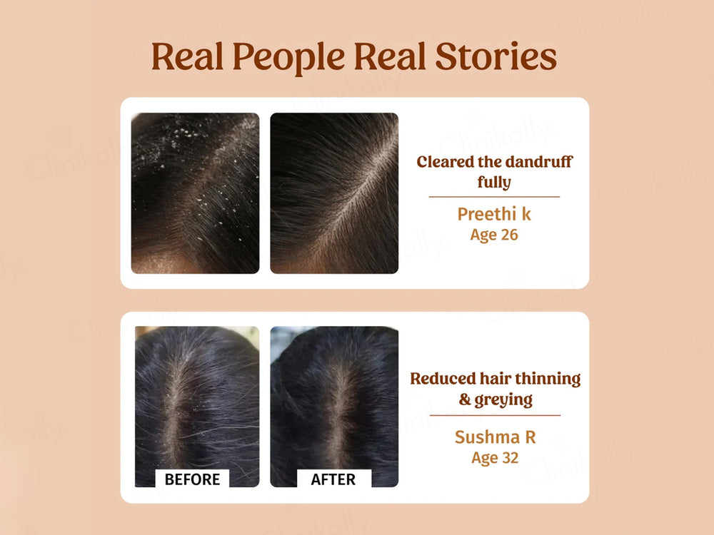 Vilvah Store Herbal Dandruff Control Shampoo