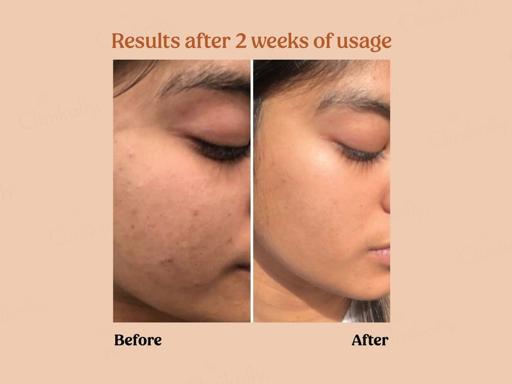 Vilvah Store Milk Powder Face Wash