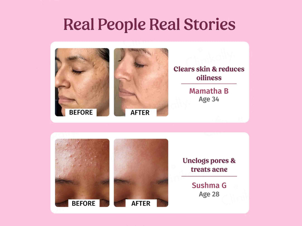 Vilvah Store Pure Rose Water Facial Toner