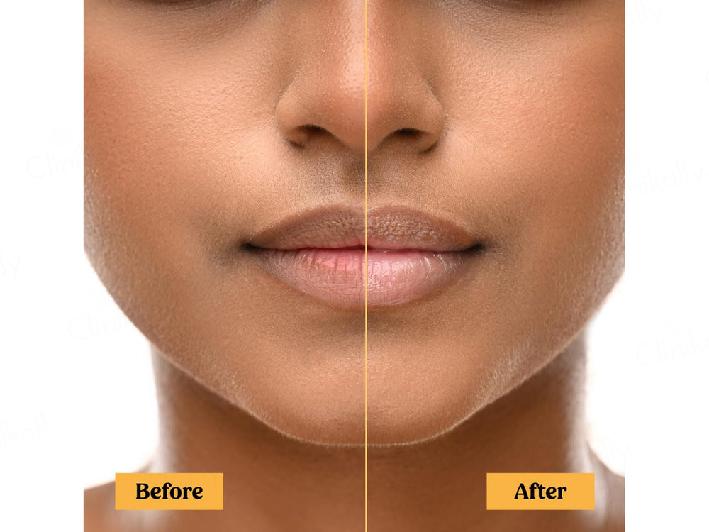 Vilvah Store Soy Milk Lip Balm SPF 30 PA+++