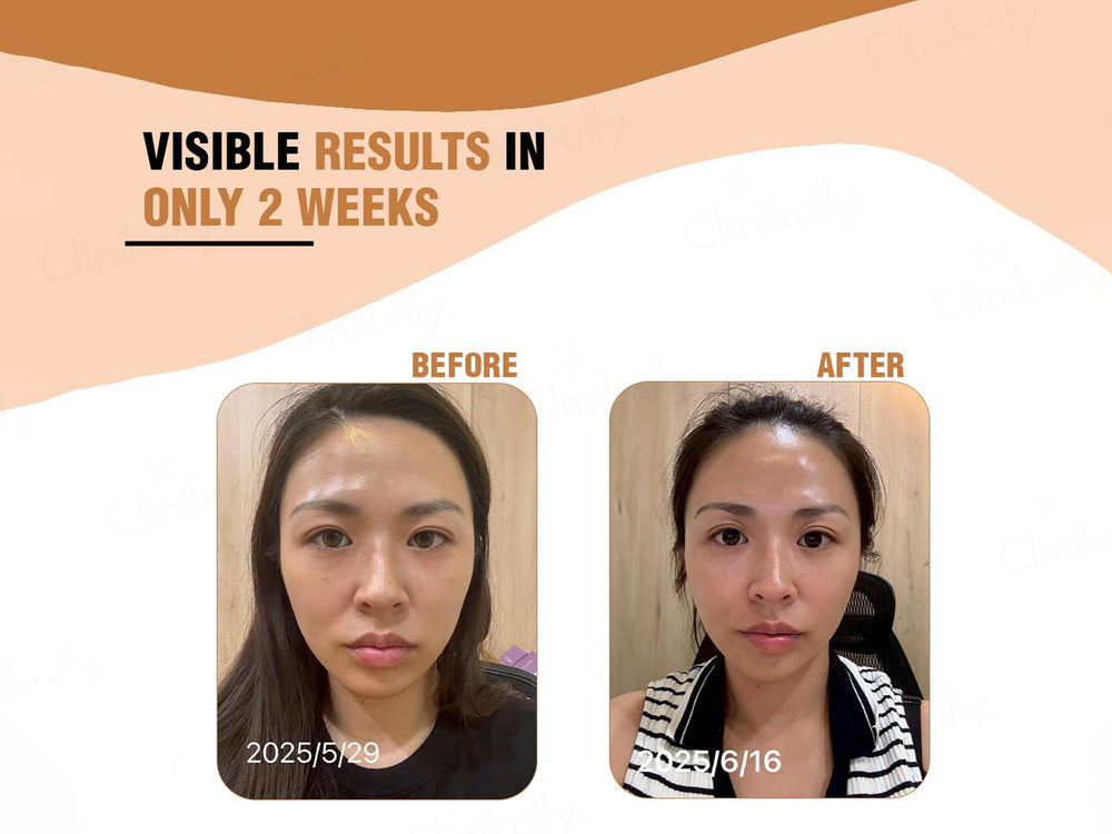 iMeMyself Well Aging Dietary Supplement Vegetarian Capsule