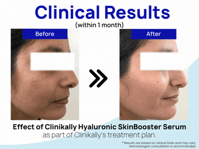 Clinikally Hyaluronic SkinBooster Serum