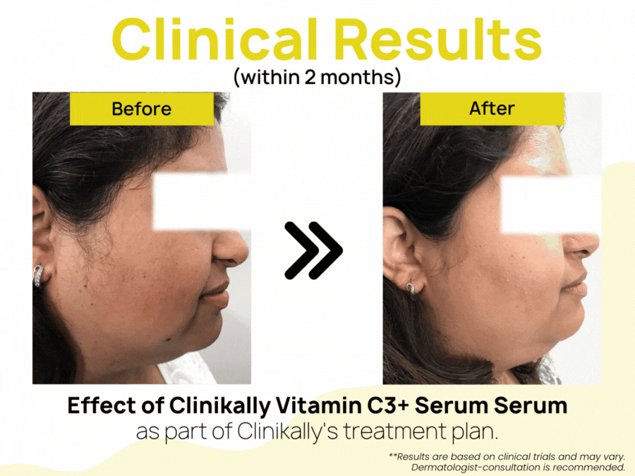 Clinikally Vitamin C3+ Serum